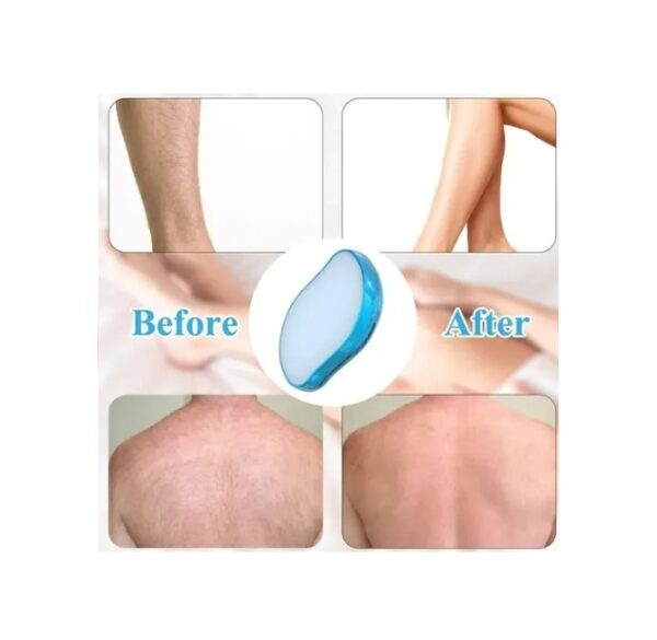 Piedra Depiladora Magica Exfoliante Sin Dolor - Imagen 2