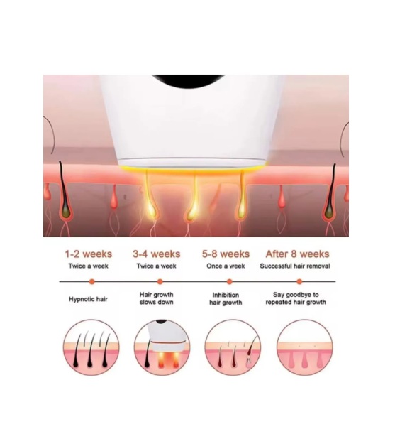 Depiladora De Luz Pulsada Láser Profesional Lambo Tech - Imagen 3